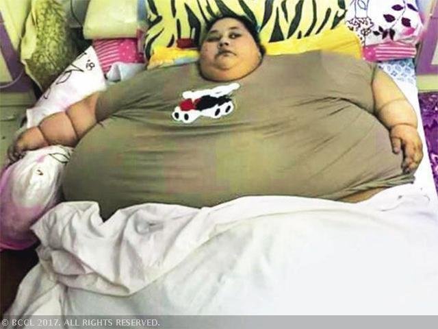 World’s Fattest Woman Sheds 323kg