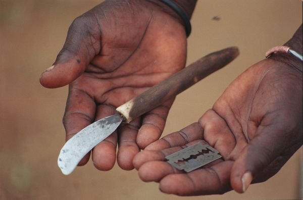 Female Genital Mutilation: Separating the Myth from the Matter