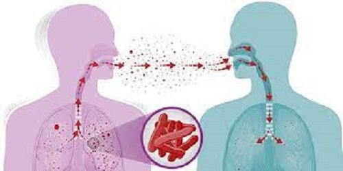 Worries arise as TB scourge persists in Nigeria